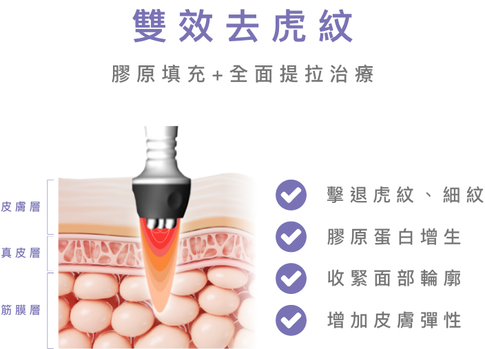 雙效去虎紋